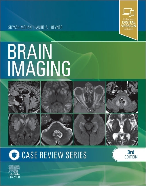 Brain Imaging Case Review Paperback Elsevier