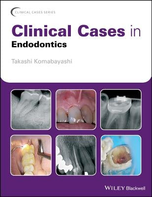 Clinical Cases in Endodontics Paperback Wiley-Blackwell