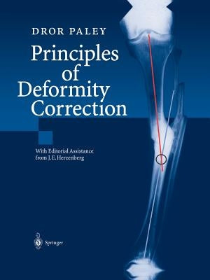 Principles of Deformity Correction Paperback Springer