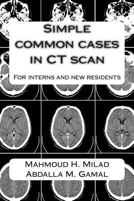 Simple common cases in CT scan: For interns and new residents Paperback Createspace Independent Publishing Platform