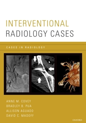 Interventional Radiology Cases Paperback Oxford University Press, USA