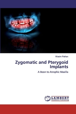 Zygomatic and Pterygoid Implants Paperback LAP Lambert Academic Publishing