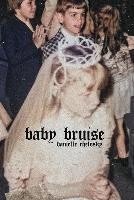Baby Bruise by Chelosky, Danielle