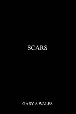 Scars: for the ones that got away by Wales, Gary A.