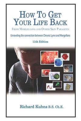 How to Get Your Life Back From Morgellons and Other Skin Parasites Limited Edit by Kalmbah, Jonquelyn