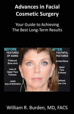 Advances in Facial Cosmetic Surgery: Your Guide to Achieving the Best Long-Term Results Paperback William Burden