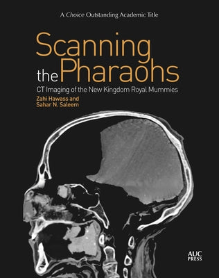 Scanning the Pharaohs: CT Imaging of the New Kingdom Royal Mummies Paperback American University in Cairo Press