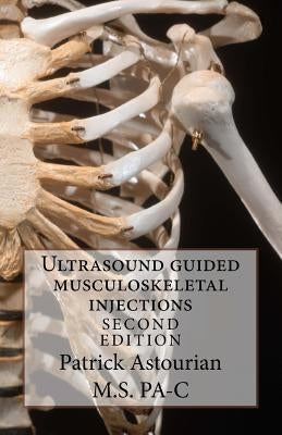 Ultrasound guided musculoskeletal injections Paperback Createspace Independent Publishing Platform