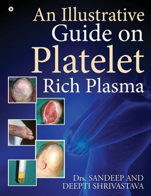 An Illustrative Guide on Platelet Rich Plasma Paperback Notion Press Media Pvt Ltd