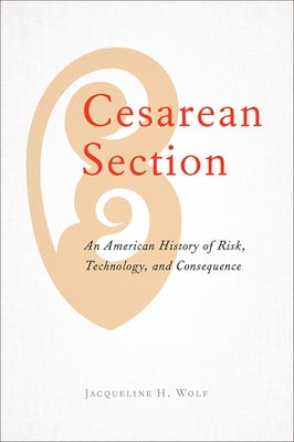 Cesarean Section: An American History of Risk, Technology, and Consequence Paperback Johns Hopkins University Press