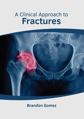 A Clinical Approach to Fractures by Gomez, Brandon