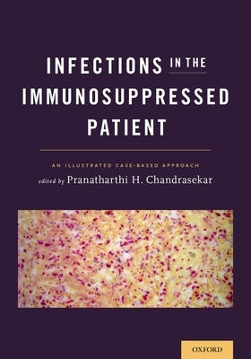 Infections in the Immunosuppressed Patient: An Illustrated Case-Based Approach Paperback Oxford University Press, USA