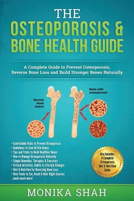 Osteoporosis: The Osteoporosis & Bone Health Guide: A Complete Guide to Prevent Osteoporosis, Reverse Bone Loss and Build Stronger B by Shah, Monika