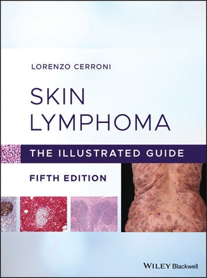 Skin Lymphoma by Cerroni, Lorenzo