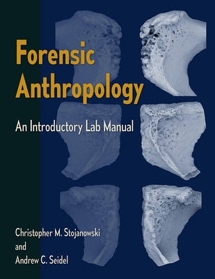 Forensic Anthropology: An Introductory Lab Manual Paperback University of Florida Press