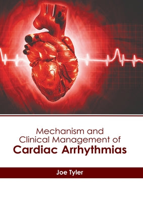 Mechanism and Clinical Management of Cardiac Arrhythmias by Tyler, Joe