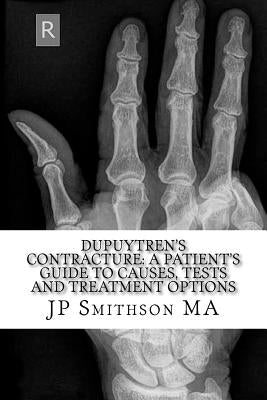 Dupuytren's Contracture: : A Patient's Guide to Causes, Tests and Treatment Option by Gay MD, H. M.