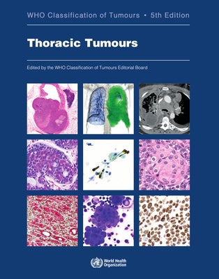 Thoracic Tumours: Who Classification of Tumours Paperback World Health Organization