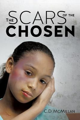 The Scars of the Chosen Paperback Xulon Press