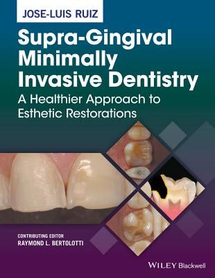 Supra-Gingival Minimally Invasive Dentistry: A Healthier Approach to Esthetic Restorations by Ruiz, Jose-Luis