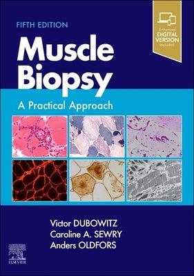 Muscle Biopsy: A Practical Approach by Dubowitz, Victor