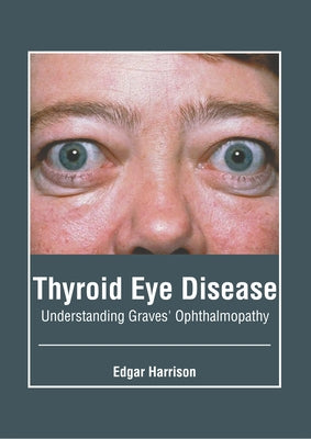 Thyroid Eye Disease: Understanding Graves' Ophthalmopathy by Harrison, Edgar