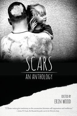 Scars: An Anthology by Wood, Erin