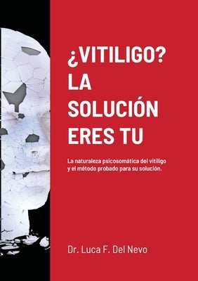 ¿Vitiligo? La Solución Eres Tu by Del Nevo, Luca F.