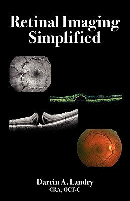 Retinal Imaging Simplified Paperback Bryson Taylor Publishing