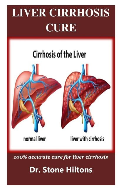 Liver Cirrhosis Cure: 100% accurate cure for liver cirrhosis by Hiltons, Stone