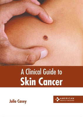 A Clinical Guide to Skin Cancer by Casey, Julio