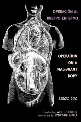 Operación al Cuerpo Enfermo / Operation on a Malignant Body by Loo, Sergio