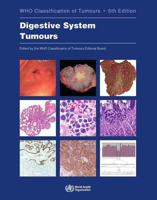 Digestive System Tumours: Who Classification of Tumours Paperback World Health Organization