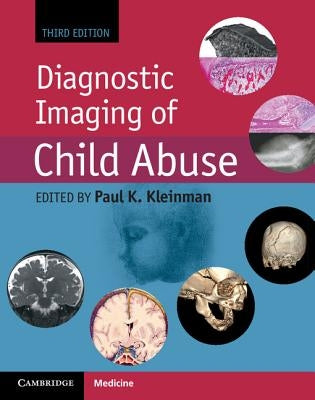 Diagnostic Imaging of Child Abuse by Kleinman, Paul K.