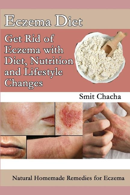 Eczema Diet - Get Rid of Eczema with Diet, Nutrition and Lifestyle Changes: Natural Homemade Remedies for Eczema by Chacha, Smit