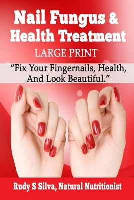 Nail Fungus and Health Treatment: Large Print: Fix Your Fingernail's Health And Look Beautiful by Silva, Rudy Silva