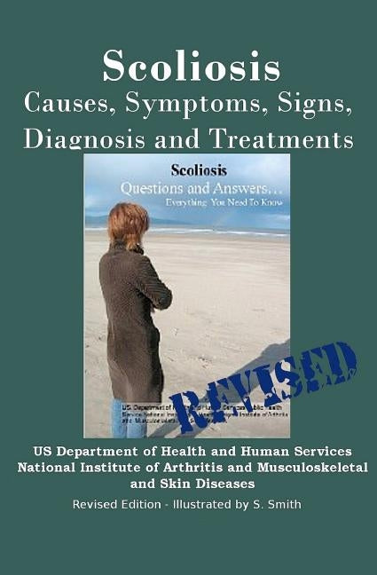 Scoliosis: Revised Edition: Causes, Symptoms, Signs, Diagnosis and Treatments by Smith, S.