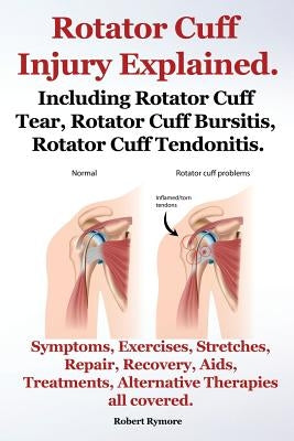 Rotator Cuff Injury Explained. Including Rotator Cuff Tear, Rotator Cuff Bursitis, Rotator Cuff Tendonitis. Symptoms, Exercises, Stretches, Repair, Re Imb Publishing