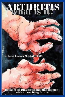 Arthritis what is it?: Decades of Diagnosis and Management with an exciting future by Argen Facp, Ralph J.