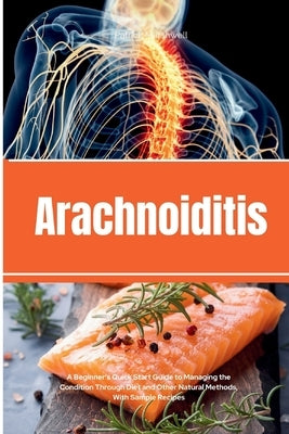 Arachnoiditis: A Beginner's Quick Start Guide to Managing the Condition Through Diet and Other Natural Methods, With Sample Recipes by Marshwell, Patrick