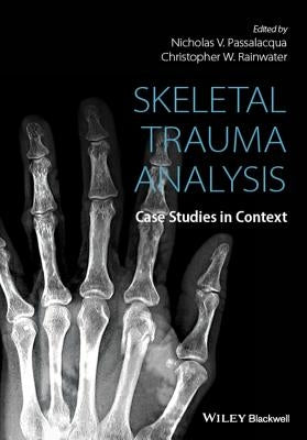 Skeletal Trauma Analysis by Passalacqua, Nicholas V.