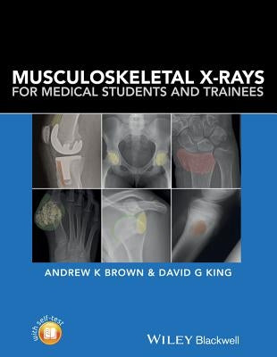 Musculoskeletal X-rays PB Paperback John Wiley & Sons