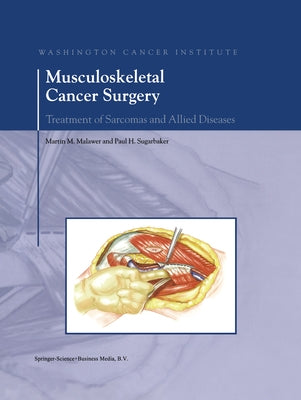 Musculoskeletal Cancer Surgery: Treatment of Sarcomas and Allied Diseases by Malawer, Martin M.