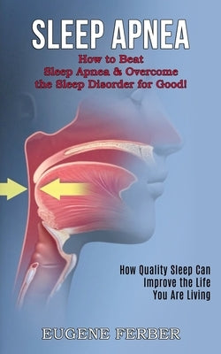 Sleep Apnea: How Quality Sleep Can Improve the Life You Are Living (How to Beat Sleep Apnea & Overcome the Sleep Disorder for Good! by Ferber, Eugene