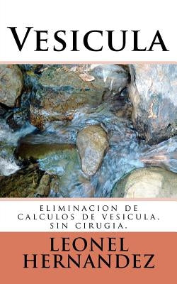 Vesicula: eliminacion de calculos de vesicula, sin cirugia. by Hernandez, J. L.