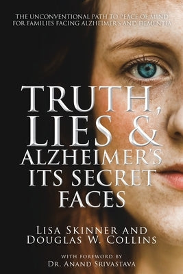 Truth, Lies & Alzheimer's: Its Secret Faces by Skinner, Lisa