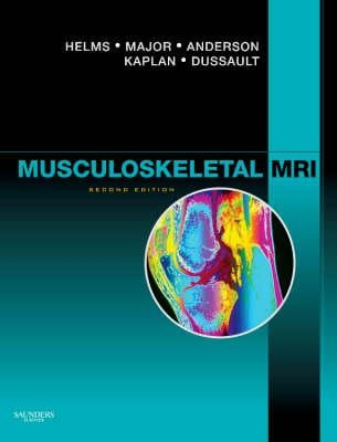 Musculoskeletal MRI by Helms, Clyde A.