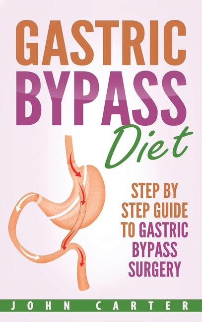 Gastric Bypass Diet: Step By Step Guide to Gastric Bypass Surgery by Carter, John