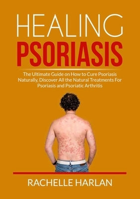 Healing Psoriasis: The Ultimate Guide on How to Cure Psoriasis Naturally, Discover All the Natural Treatments For Psoriasis and Psoriatic by Harlan, Rachelle