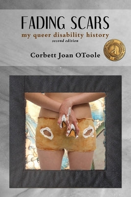 Fading Scars: My Queer Disability History, 2nd Edition by Otoole, Corbett Joan